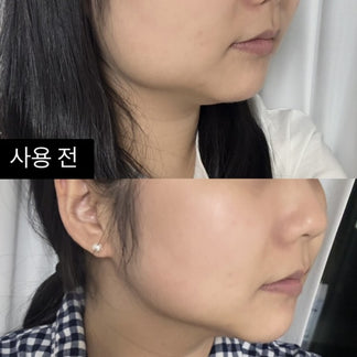 【韓網代購】全港獨家 無痛醫美級 InMode 科技 即時溶脂槍