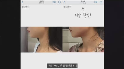 【韓網代購】全港獨家 無痛醫美級 InMode 科技 即時溶脂槍